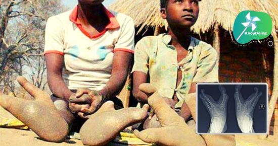 นี่คือรูปร่างของ “เท้า”(นกกระจอกเทศ) ในชนเผ่าวาโดมา